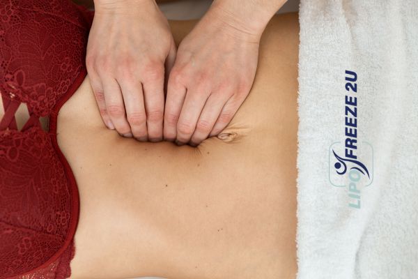 diastasis recti treatment Northampton