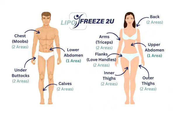Areas you can have fat freezing treatment Northampton