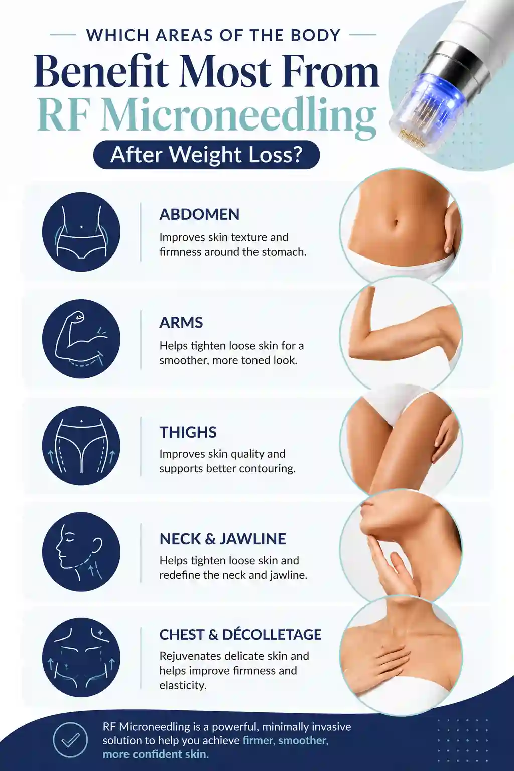 Which Areas of the Body Benefit Most From RF Microneedling After Weight Loss Northampton